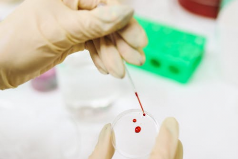 bild-messung tropfen bild-messung tropfen